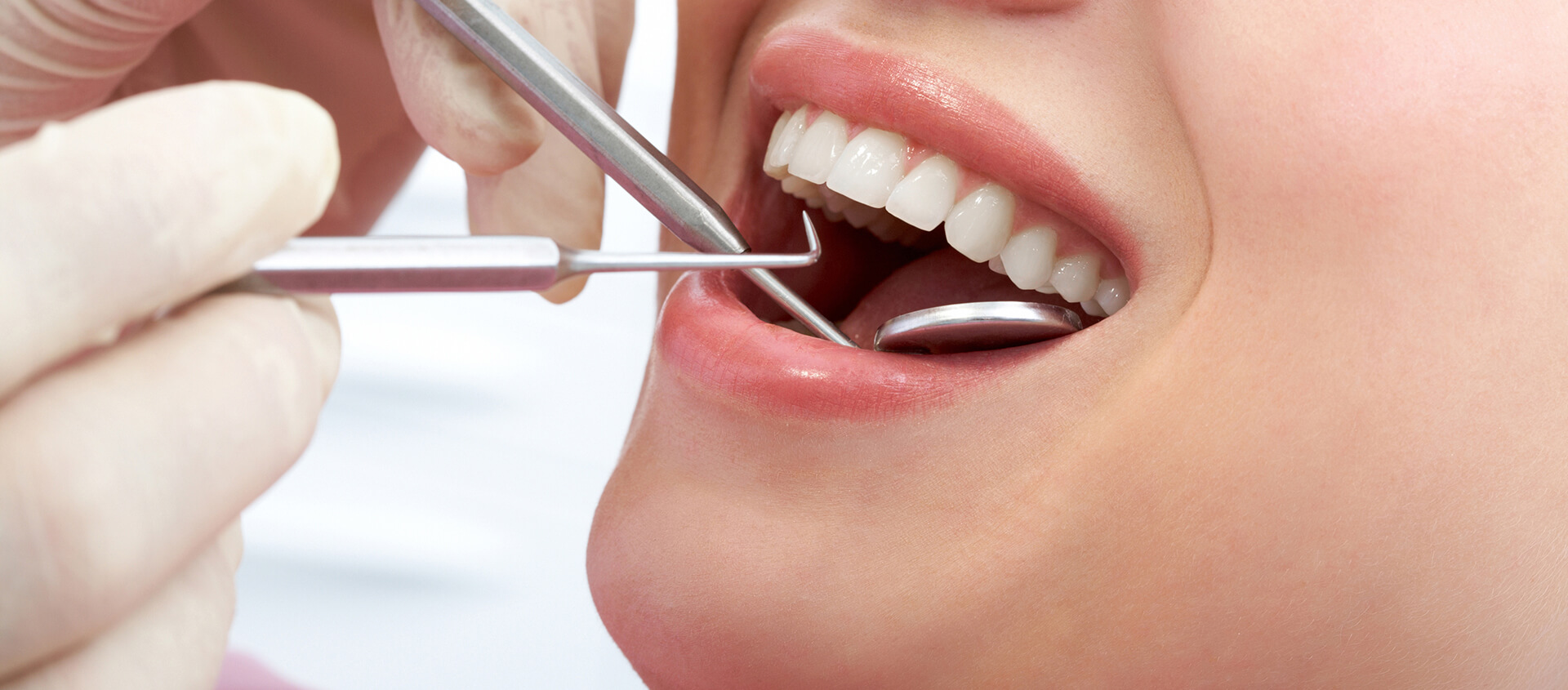 Treat Staining in a Single Visit with a Teeth Whitening Dentist in Middletown, IN Area