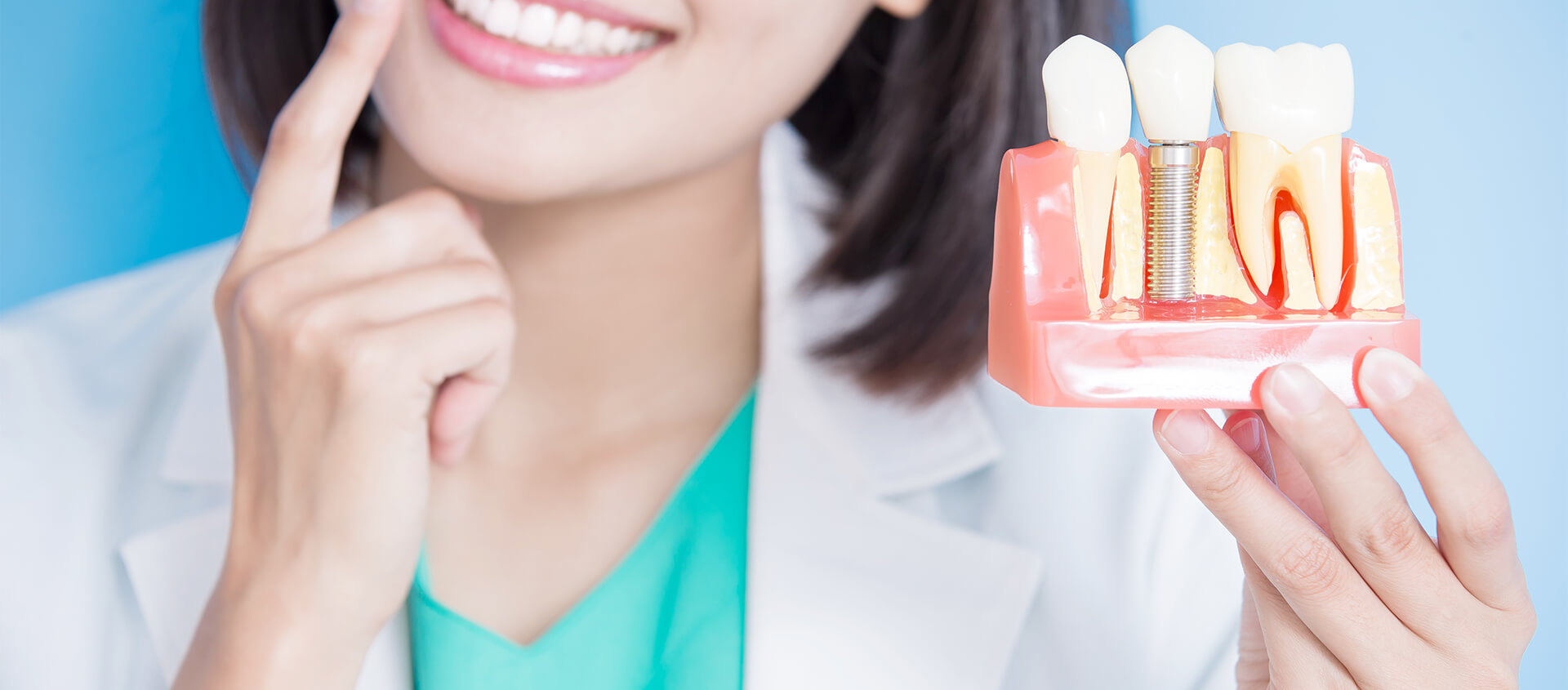 Affordable Dental Implants in Anderson IN Area