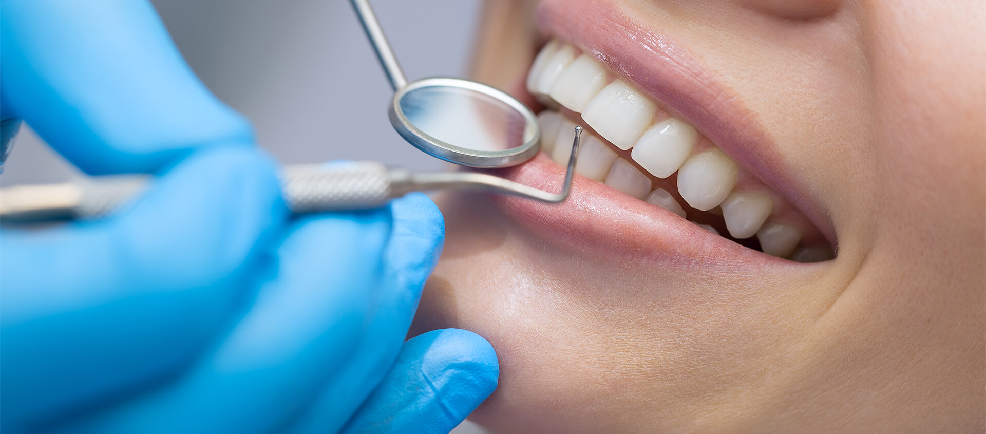 Dental Filling Procedure in Pendleton IN Area