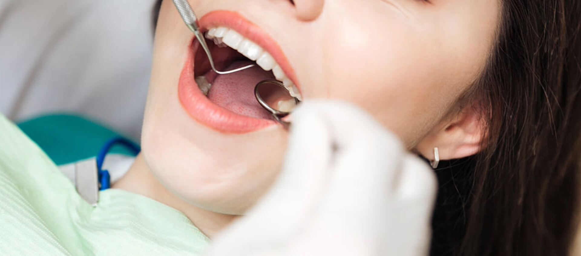 Removing Plaque From Teeth in Muncie IN area